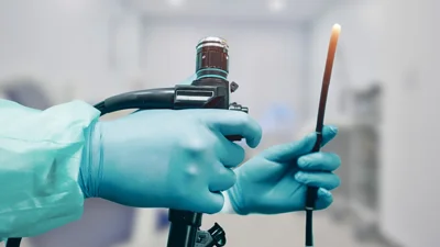 Diagnostic and Therapeutic Endoscopy